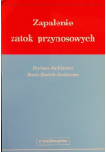 Zapalenie zatok przynosowych