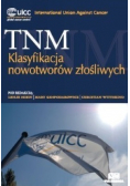 TNM klasyfikacja nowotworów złośliwych
