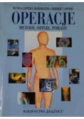 Operacje metody opinie porady