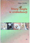 Stany nagłe w endodoncji