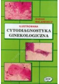 Cytodiagnostyka ginekologiczna