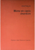 Blizna po cięciu cesarskim