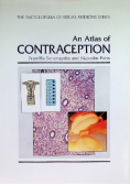 An Atlas of Contraception
