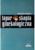 Laparoskopia ginekologiczna