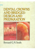 Dental Crowns and bridges