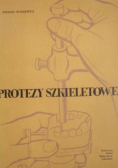 Protezy szkieletowe