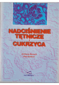 Nadciśnienie tętnicze i cukrzyca