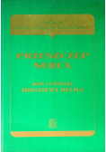 Przeszczep serca
