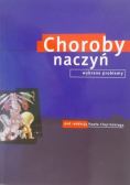 Choroby naczyń