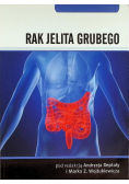 Rak jelita grubego