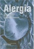Alergia