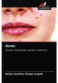 Acne