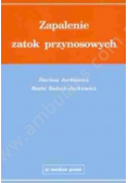 Zapalenie zatok przynosowych
