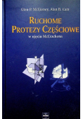 Ruchome protezy częściowe