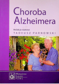 Choroba Alzheimera