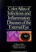 Color Atlas of Infectious and Inflammatory Diseases of the External Eye