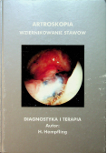 Artroskopia wziernikowanie stawów Diagnostyka i terapia