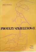 Protezy szkieletowe