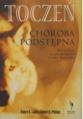 Toczeń choroba podstępna
