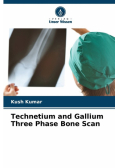 Technetium and Gallium Three Phase Bone Scan