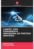Lasers
