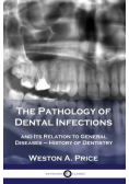 The Pathology of Dental Infections