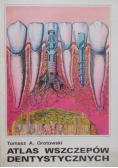 Atlas wszczepów dentystycznych