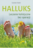 Halluks Leczenie holistyczne bez operacji