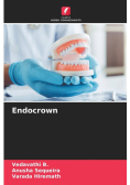 Endocrown