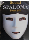 Spalona żywcem