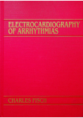 Electrocardiography of Arrhythmias