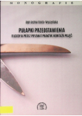 Pułapki przedstawienia