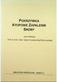 Pokrzywka Atopowe zapalenie skóry