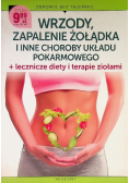 Wrzody zapalenie żołądka i inne choroby układy pokarmowego