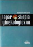 Laparoskopia ginekologiczna