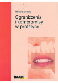 Ograniczenia i kompromisy w protetyce