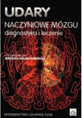 Udary naczyniowe mózgu diagnostyki i leczenie