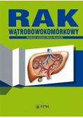Rak wątrobowokomórkowy