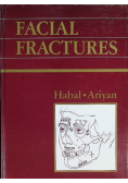 Facial Fractures