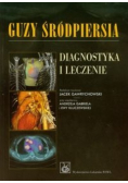 Guzy śródpiersia. Diagnostyka i leczenie