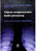 Zdjecie rentgenowskie klatki piersiowej