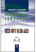 Ilustrowany leksykon zespołów w dermatologii Tom 1 A-E