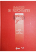 Images in Psychiatry