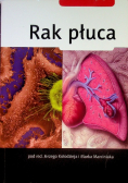 Rak płuca