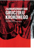 Zaawansowany rak gruczołu krokowego