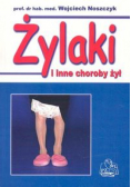 Żylaki i inne choroby żył