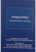 Pokrzywki. Rozpoznawanie i leczenie