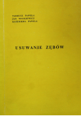 Usuwanie zębów