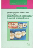 Uzupełnienia adhezyjne zębów leczonych endodontycznie