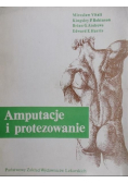 Amputacja i protezowanie